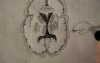 Basal Ganglia - Neuroanatomy Lectures - 30