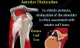 Shoulder Dislocations - Conditions and Treatment