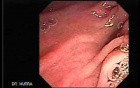 Larynx with Jaundice (4 of 6)