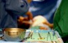 Minimally Invasive Thoracic Surgey Unit