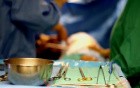 Minimally Invasive Thoracic Surgey Unit