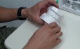 Orthodontic Case #2 - Review Of Chief Complaint W/ Models