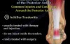 Posterior Ankle, Anatomy And Injury 