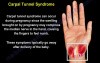 Causes and Treatment of the Wrist Pain - Part 1