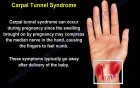 Causes and Treatment of the Wrist Pain - Part 1