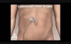 Amerra 3D Medical Visualization - Demo Trailer 2009