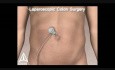 Amerra 3D Medical Visualization - Demo Trailer 2009