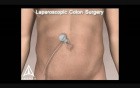 Amerra 3D Medical Visualization - Demo Trailer 2009