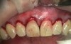 Old Crown Margin Makeover