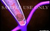 Deep Vein Thrombosis (DVT) And Pulmonary Embolism