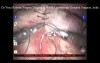 Robotic Surgeon's Knot