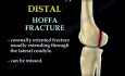 Fracture Femur Types 