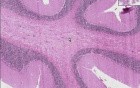 Adrenoleukodystrophy