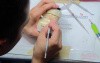 Anterior Waxup Correction Part 2 - Big Picture To Little Picture