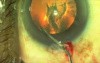 Plasma Ablation Capsulotomy - Fugo Blade Or Femtosecond Laser?