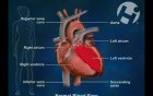 Normal Arterial Blood Supply to the Brain