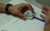 Slow/Rapid Palatal Expansion - Appliance Back From Lab