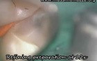 Conservative Dentistry - IDS International Dental Show - 22/26 Mar, 2011 Cologne