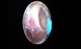 Endometrial ablation with hystero-resector