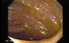 Rectum (21 of 30)