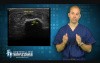 Ultrasound Technology used to treat Plantar Fasciitis, Achilles Tendinitis