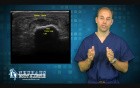 Ultrasound Technology used to treat Plantar Fasciitis, Achilles Tendinitis