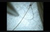 Microsurgery Tutorials. Bonus: Thinner than a strand of hair!