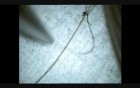 Microsurgery Tutorials. Bonus: Thinner than a strand of hair!