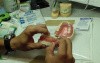 Dental Bridge Hygiene 101