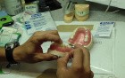 Dental Bridge Hygiene 101