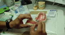 Dental Bridge Hygiene 101