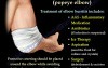 Bursitis Elbow - Video Lecture