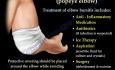 Bursitis Elbow - Video Lecture