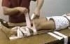 Knee Fracture Dislocation