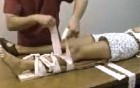Knee Fracture Dislocation
