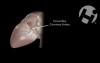 Normal Cardiac Anatomy and Physiology