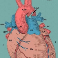 Shade Tree Cardiology