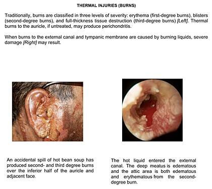 Diseases Of The Ear Volume1 The Pinna
