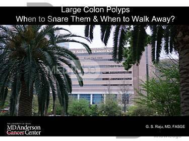 Large Colon Polyps - When to Snare & When to Walk Away- St. Louis Course