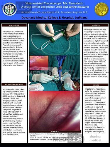 Video Assisted Thoracoscopic Talc Pleurodesis