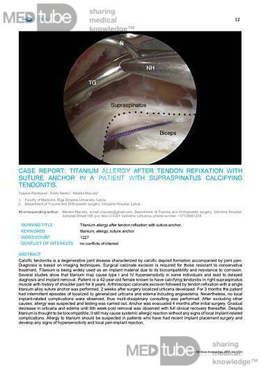 MEDtube Science 2017 - Case Report: Titanium Allergy After Tendon Refixation With Suture Anchor in a Patient With Supraspinatus Calcifying Tendonitis.