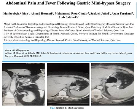 Abdominal Pain and Fever Following Gastric Mini-bypass Surgery