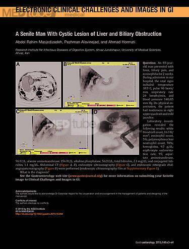 An Older Man with Cystic Lesion of Liver