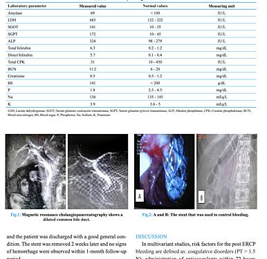 An Unusual Treatment for Massive and Refractory Bleeding after Endoscopic Retrograde Cholangiopancreatography