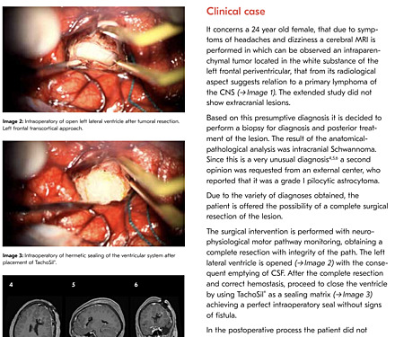 Compilation of 25 Very Interesting Clinical Case Reports in the Field of Neurosurgery