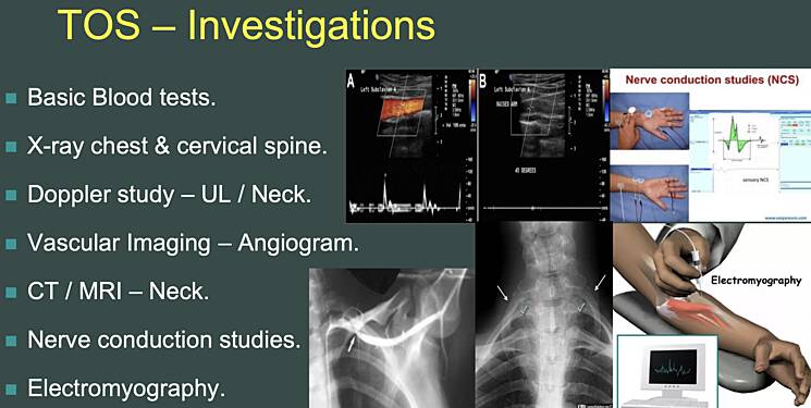 Arteritis, TAO, RP & TOS • Publication • MEDtube.net