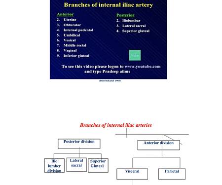 Laparoscopic Internal iliac Artery Ligation for Dysfunctional Uterine Bleeding