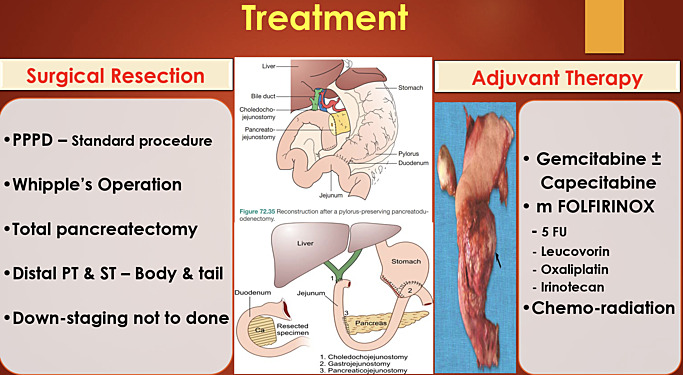 Pancreatic Tumours
