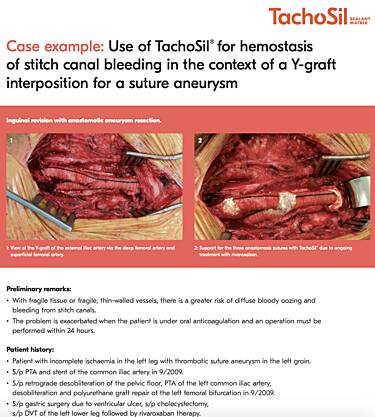 Use of TachoSil® for Efficient Haemostasis and Suture Support in the Case of Stitch Canal Bleedings in Vascular Anastomoses, PD, Arndt Hribaschek