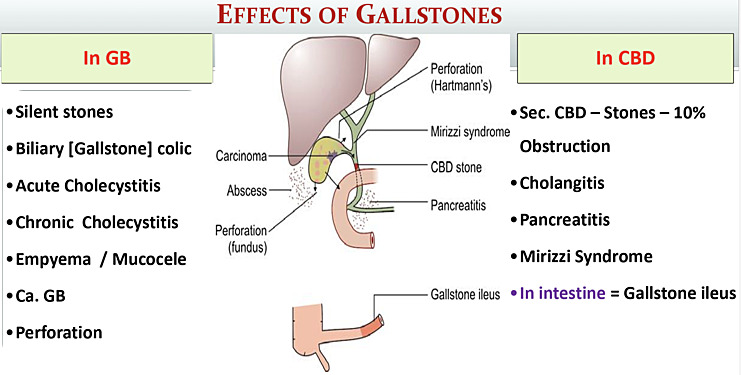 Diseases of Gallbladder